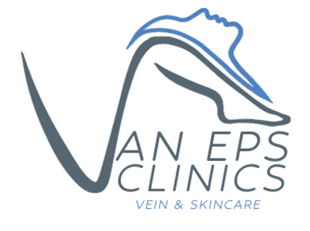 dutch vein clinic